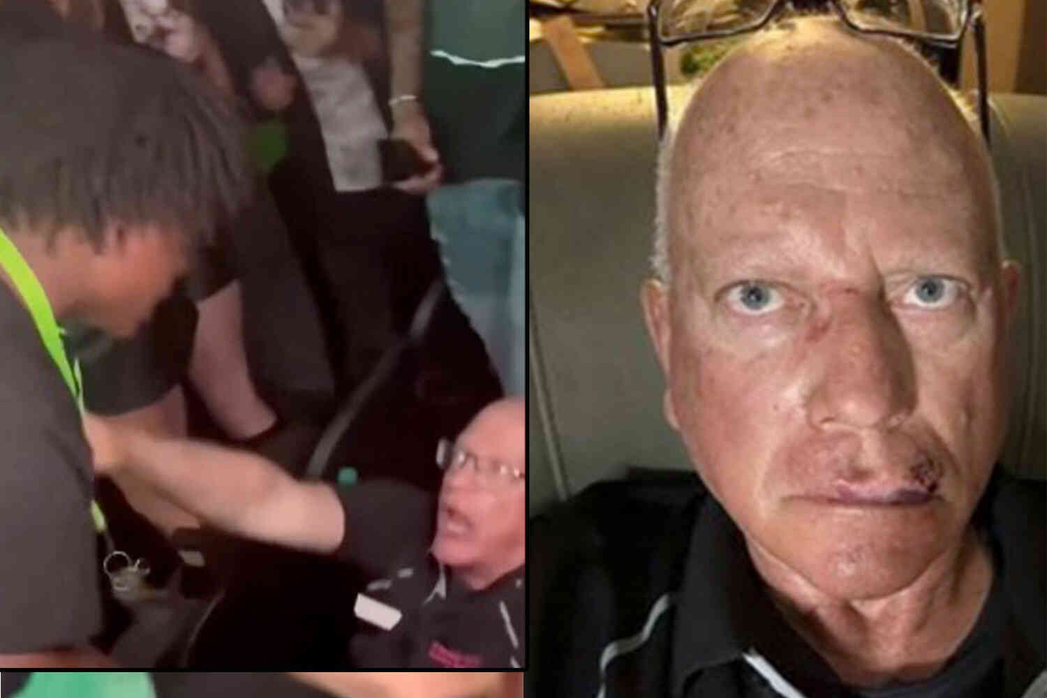 Thumbnail for Employee suffers 'horrific' injuries after being assaulted by 14-year-old at Kansas City rap concert
